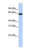 Sodium-dependent phosphate transport protein 2C antibody, orb329612, Biorbyt, Western Blot image 