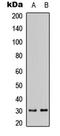 Dehydrogenase/Reductase 11 antibody, LS-C368578, Lifespan Biosciences, Western Blot image 