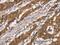 Desmocollin 2 antibody, MBS2521513, MyBioSource, Immunohistochemistry paraffin image 