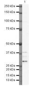 HIV-1 Tat Interactive Protein 2 antibody, PA5-19827, Invitrogen Antibodies, Western Blot image 