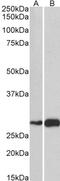 Activating Transcription Factor 5 antibody, PA5-17988, Invitrogen Antibodies, Western Blot image 