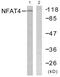 Nuclear Factor Of Activated T Cells 3 antibody, PA5-38304, Invitrogen Antibodies, Western Blot image 