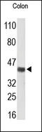 C-X-C Motif Chemokine Receptor 2 antibody, 251850, Abbiotec, Western Blot image 