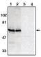 ADAM Metallopeptidase Domain 10 antibody, orb108708, Biorbyt, Western Blot image 