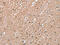 RAB8A, Member RAS Oncogene Family antibody, CSB-PA249917, Cusabio, Immunohistochemistry paraffin image 