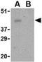 Programmed Cell Death 1 antibody, NBP1-77277, Novus Biologicals, Western Blot image 