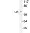 LCK Proto-Oncogene, Src Family Tyrosine Kinase antibody, LS-C177792, Lifespan Biosciences, Western Blot image 