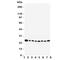 RAB8A, Member RAS Oncogene Family antibody, R31404, NSJ Bioreagents, Western Blot image 