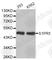 Sphingosine-1-Phosphate Receptor 5 antibody, A4773, ABclonal Technology, Western Blot image 