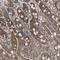 Protein Phosphatase, Mg2+/Mn2+ Dependent 1B antibody, NBP1-87250, Novus Biologicals, Immunohistochemistry paraffin image 