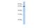 ZXD Family Zinc Finger C antibody, A10764, Boster Biological Technology, Western Blot image 