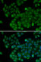 DNA Methyltransferase 3 Like antibody, 18-612, ProSci, Immunofluorescence image 