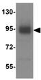 Lysine Demethylase 1A antibody, GTX31950, GeneTex, Western Blot image 