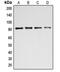 BTB Domain And CNC Homolog 1 antibody, MBS822159, MyBioSource, Western Blot image 