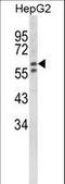 Hexosaminidase Subunit Alpha antibody, LS-C166844, Lifespan Biosciences, Western Blot image 