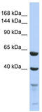 Testis Expressed 11 antibody, TA335437, Origene, Western Blot image 