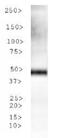 Tryptophan Hydroxylase 2 antibody, NBP1-77556, Novus Biologicals, Western Blot image 