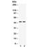 Mitogen-Activated Protein Kinase Kinase 7 antibody, R31800, NSJ Bioreagents, Western Blot image 