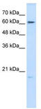 Glutathione peroxidase 3 antibody, TA346086, Origene, Western Blot image 