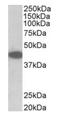 Tribbles Pseudokinase 1 antibody, orb125207, Biorbyt, Western Blot image 