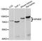 NFKB Inhibitor Zeta antibody, STJ112516, St John