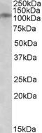 Glutamate Ionotropic Receptor NMDA Type Subunit 3B antibody, EB10211, Everest Biotech, Western Blot image 