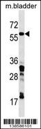 Coronin 1C antibody, 60-052, ProSci, Western Blot image 