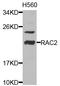 Ras-related C3 botulinum toxin substrate 2 antibody, STJ25274, St John