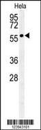 Polypeptide N-Acetylgalactosaminyltransferase 4 antibody, 55-079, ProSci, Western Blot image 