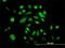 DNA Polymerase Kappa antibody, H00051426-M01, Novus Biologicals, Immunocytochemistry image 