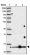 Splicing Factor 3b Subunit 6 antibody, PA5-57078, Invitrogen Antibodies, Western Blot image 