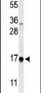 DAZ Associated Protein 2 antibody, PA5-26972, Invitrogen Antibodies, Western Blot image 