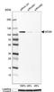 Minichromosome Maintenance Complex Component 4 antibody, NBP1-85728, Novus Biologicals, Western Blot image 