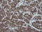 Crystallin Alpha A antibody, M01900-1, Boster Biological Technology, Immunohistochemistry paraffin image 
