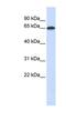 Frizzled Class Receptor 4 antibody, PA5-41972, Invitrogen Antibodies, Western Blot image 