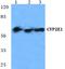 Cytochrome P450 Family 2 Subfamily E Member 1 antibody, A00672-2, Boster Biological Technology, Western Blot image 