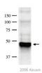 Protein Phosphatase, Mg2+/Mn2+ Dependent 1A antibody, ab14824, Abcam, Western Blot image 