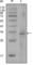 Coagulation Factor VIII antibody, abx015745, Abbexa, Western Blot image 