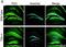 Tryptophan 2,3-Dioxygenase antibody, H00006999-B01P, Novus Biologicals, Immunohistochemistry paraffin image 