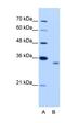 RNA Binding Motif Protein 4B antibody, orb324927, Biorbyt, Western Blot image 