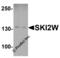 G-protein coupled receptor-associated sorting protein 1 antibody, 7993, ProSci Inc, Western Blot image 