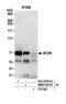 Neurochondrin antibody, NBP2-59115, Novus Biologicals, Western Blot image 