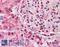 Nibrin antibody, LS-B1701, Lifespan Biosciences, Immunohistochemistry paraffin image 