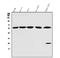 Karyopherin Subunit Alpha 1 antibody, A04024-1, Boster Biological Technology, Western Blot image 