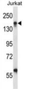 Integrin Subunit Alpha L antibody, abx027540, Abbexa, Western Blot image 