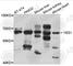 YES Proto-Oncogene 1, Src Family Tyrosine Kinase antibody, A0628, ABclonal Technology, Western Blot image 
