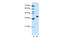 Heterogeneous Nuclear Ribonucleoprotein A3 antibody, 29-527, ProSci, Western Blot image 