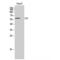 DNA nucleotidylexotransferase antibody, LS-C386375, Lifespan Biosciences, Western Blot image 