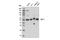 ETS Proto-Oncogene 1, Transcription Factor antibody, 14069S, Cell Signaling Technology, Western Blot image 