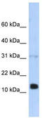 Regenerating Family Member 1 Beta antibody, TA334724, Origene, Western Blot image 